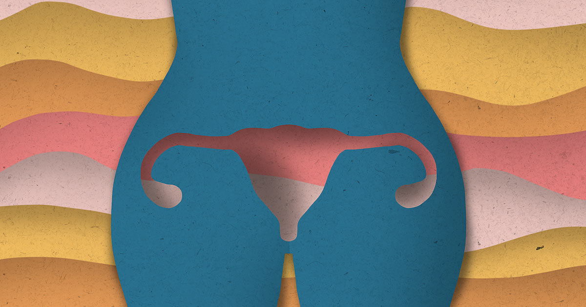 Community Views Endometriosis Pain After Hysterectomy