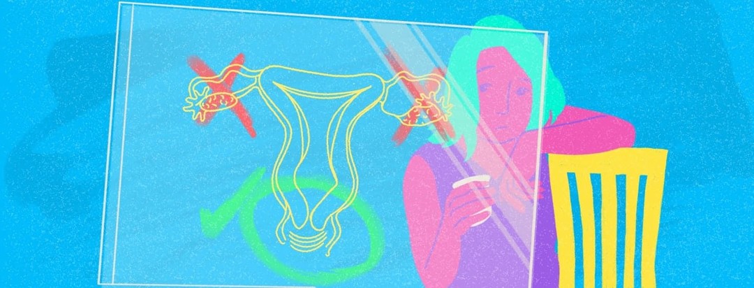 Woman looking at glass marker board with drawing of the uterine system drawn on it. There are X's through the drawing of the fallopian tubes and a green circle around the cervix