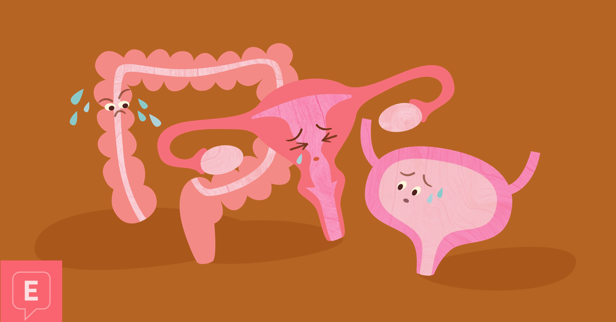 Retroverted Uterus: Causes, Fertility, Treatment, and More.