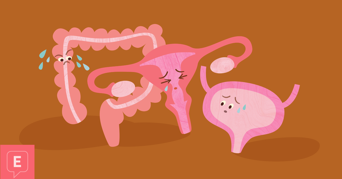 retroverted uterus