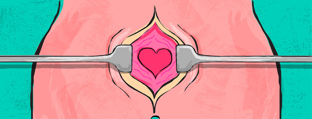 An illustration of the pelvic region being pulled apart during excision, but uncovering a heart inside to show that care is being taken not just during surgery, but post-op.