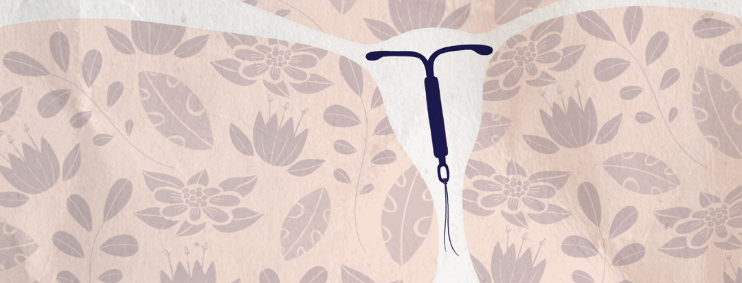 A Mirena IUD sits inserted into the uterus with a floral pattern background.