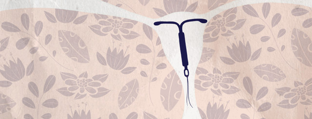 Does The Mirena IUD Help Endometriosis? image