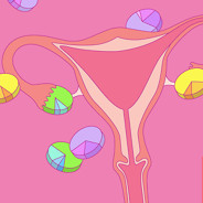 The Endometriosis Treatment Journey image