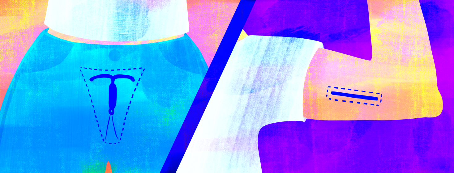 Treating Endometriosis with Long Acting Reversible Contraceptives