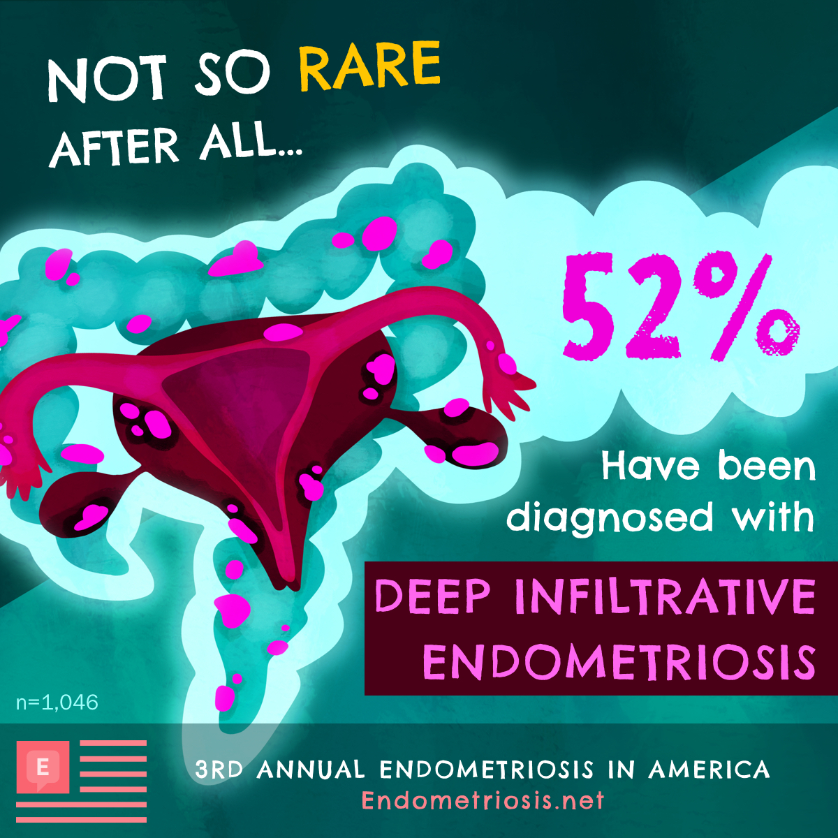 52% have been diagnosed with deep infiltrative endometriosis.