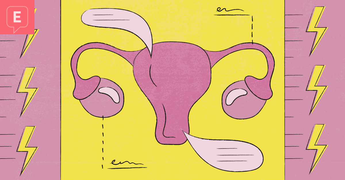 A Guide to the Types, Stages, and Severity of Endometriosis