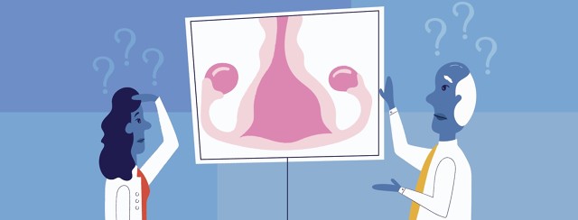 Are Doctors Looking At Endometriosis the Wrong Way? image