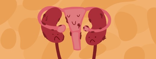 Endometriosis of the Kidneys and Bladder image