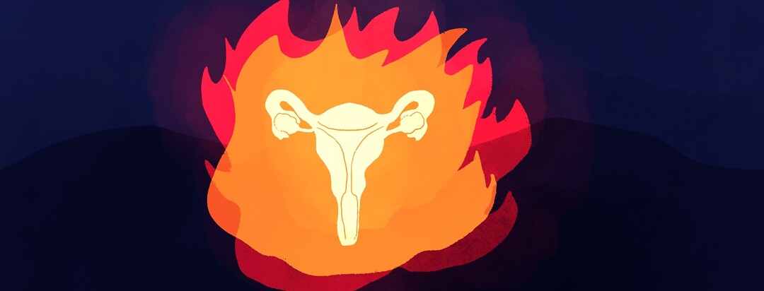 A uterus surrounded by flames
