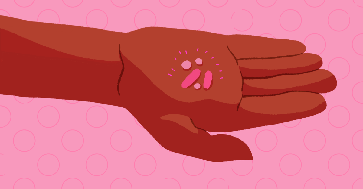 Nonhormonal Treatments for Endometriosis